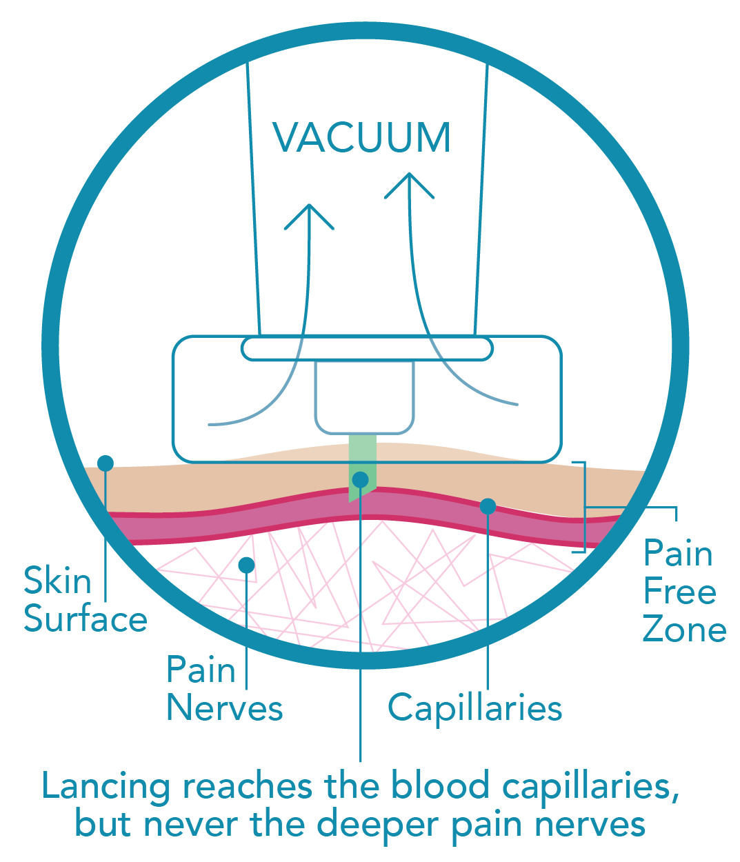 Genteel Plus Lancing Device